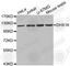 DEAH-Box Helicase 16 antibody, A5946, ABclonal Technology, Western Blot image 