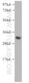 Phosphatidylinositol Transfer Protein Beta antibody, 13110-1-AP, Proteintech Group, Western Blot image 