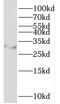 Homeobox protein Nkx-2.2 antibody, FNab05750, FineTest, Western Blot image 