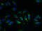 Solute Carrier Family 17 Member 4 antibody, LS-C398015, Lifespan Biosciences, Immunofluorescence image 