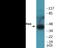 Neutrophil Cytosolic Factor 1 antibody, EKC2324, Boster Biological Technology, Western Blot image 