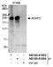 A-Kinase Anchoring Protein 2 antibody, NB100-61604, Novus Biologicals, Immunoprecipitation image 