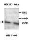 Cyclin-dependent kinase 4 inhibitor C antibody, orb77026, Biorbyt, Western Blot image 