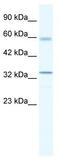 Zinc Finger And BTB Domain Containing 7A antibody, TA339480, Origene, Western Blot image 