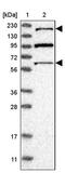 Arginine-Glutamic Acid Dipeptide Repeats antibody, PA5-54975, Invitrogen Antibodies, Western Blot image 