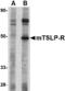 Cytokine receptor-like factor 2 antibody, A04167-2, Boster Biological Technology, Western Blot image 