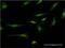 Catenin Delta 2 antibody, H00001501-M02, Novus Biologicals, Immunofluorescence image 