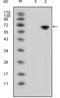 Wnt Family Member 5A antibody, abx016063, Abbexa, Enzyme Linked Immunosorbent Assay image 