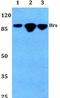 Hepatocyte Growth Factor-Regulated Tyrosine Kinase Substrate antibody, LS-B12780, Lifespan Biosciences, Western Blot image 
