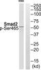 HsMAD2 antibody, AP55851PU-N, Origene, Western Blot image 