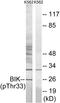 Bcl-2-interacting killer antibody, GTX55442, GeneTex, Western Blot image 