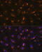 RAB11A, Member RAS Oncogene Family antibody, GTX02853, GeneTex, Immunocytochemistry image 