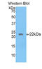 Laminin Subunit Gamma 1 antibody, LS-C295089, Lifespan Biosciences, Western Blot image 