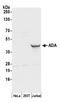ADA1 antibody, A305-183A, Bethyl Labs, Western Blot image 