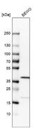 RP2 Activator Of ARL3 GTPase antibody, NBP1-82549, Novus Biologicals, Western Blot image 