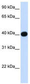 Lipoic Acid Synthetase antibody, TA346862, Origene, Western Blot image 