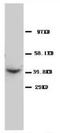 C-C Motif Chemokine Receptor 5 (Gene/Pseudogene) antibody, AP23286PU-N, Origene, Western Blot image 
