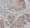 Keratin-19 antibody, FNab02210, FineTest, Immunohistochemistry frozen image 