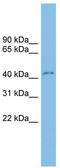 C-Type Lectin Domain Family 4 Member M antibody, TA346482, Origene, Western Blot image 