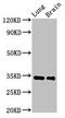Monoglyceride Lipase antibody, orb400884, Biorbyt, Western Blot image 