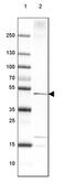 3-Hydroxyacyl-CoA Dehydratase 3 antibody, PA5-53239, Invitrogen Antibodies, Western Blot image 