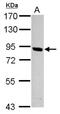 Calcium-independent phospholipase A2-gamma antibody, NBP2-19879, Novus Biologicals, Western Blot image 