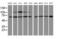 Proteasome 26S Subunit, Non-ATPase 3 antibody, MA5-25886, Invitrogen Antibodies, Western Blot image 