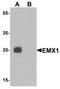 Homeobox protein EMX1 antibody, TA319638, Origene, Western Blot image 