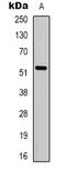 Solute Carrier Family 16 Member 12 antibody, LS-C368901, Lifespan Biosciences, Western Blot image 