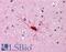 Breast Carcinoma Amplified Sequence 1 antibody, LS-B4631, Lifespan Biosciences, Immunohistochemistry paraffin image 