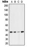 Vasodilator Stimulated Phosphoprotein antibody, LS-C352981, Lifespan Biosciences, Western Blot image 