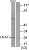 Lecithin retinol acyltransferase antibody, TA314880, Origene, Western Blot image 