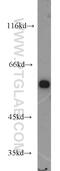 Phosphoglycerate Dehydrogenase antibody, 14719-1-AP, Proteintech Group, Western Blot image 