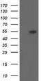 Diphthamide Biosynthesis 2 antibody, M12485-1, Boster Biological Technology, Western Blot image 