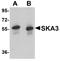 SKA3 antibody, A07561, Boster Biological Technology, Western Blot image 