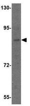 Dishevelled Binding Antagonist Of Beta Catenin 2 antibody, GTX85373, GeneTex, Western Blot image 