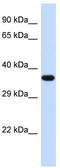 Protein Tob2 antibody, TA344453, Origene, Western Blot image 