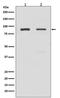 Toll Like Receptor 2 antibody, M00131, Boster Biological Technology, Western Blot image 