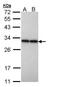 Phosphoglycerate Mutase 2 antibody, TA308935, Origene, Western Blot image 