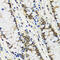 S100A10 antibody, 15-656, ProSci, Immunohistochemistry paraffin image 