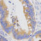 Progastricsin antibody, LS-C332246, Lifespan Biosciences, Immunohistochemistry paraffin image 
