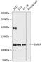 Glutamyl Aminopeptidase antibody, GTX66100, GeneTex, Western Blot image 