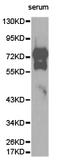 Vitronectin antibody, LS-C192932, Lifespan Biosciences, Western Blot image 