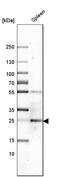 C-Type Lectin Domain Family 4 Member E antibody, HPA004935, Atlas Antibodies, Western Blot image 