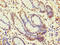 Myotubularin-related protein 13 antibody, LS-C679401, Lifespan Biosciences, Immunohistochemistry paraffin image 