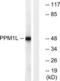 Protein phosphatase 1L antibody, LS-C120265, Lifespan Biosciences, Western Blot image 