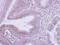 Coatomer subunit beta antibody, NBP2-15577, Novus Biologicals, Immunohistochemistry paraffin image 