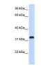 Chromosome 21 Open Reading Frame 62 antibody, NBP1-80554, Novus Biologicals, Western Blot image 