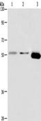 ARRB1 antibody, TA350801, Origene, Western Blot image 