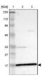 Zinc Finger Protein 226 antibody, NBP1-81632, Novus Biologicals, Western Blot image 